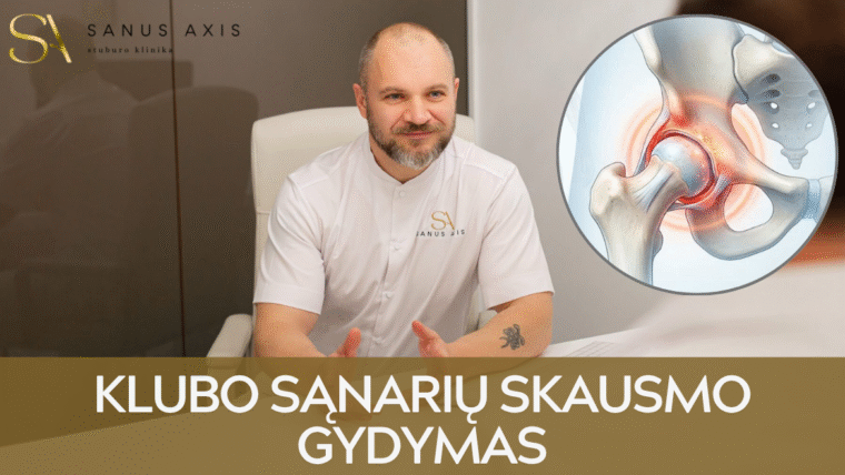 Klubo sąnarių skausmo gydymas