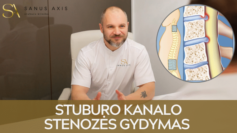 Stuburo kanalo stenozės gydymas